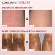 mCaffeine 11% AHA BHA Strawberry Body Lotion for Smooth Skin (200 ml)