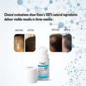 Ktein 100% Plant-Based Active Intensive Hair Treatment Serum with Acupressure Roll-On (20 ml)
