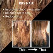 House of Beauty Blackseed Onion Oil Reduces Hair Fall With Real Kalonji Seeds Benefits (200 ml)