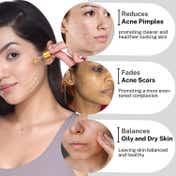 House of Beauty Acne Oil W-T Tea Tree, Avocado & Vit-E For Drying Pimpled & Oily Skin (30 ml)
