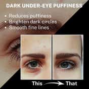 House of Beauty Instant Filler Hyaluronic Undereye Patches For Dark Circles & Plumping (2 Pairs)