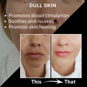 House of Beauty Rose Quartz Dermaroller