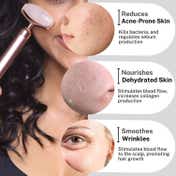 House of Beauty Rose Quartz Dermaroller