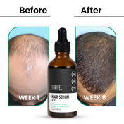 Thriveco Hair Growth 2.0 Serum (50ml)