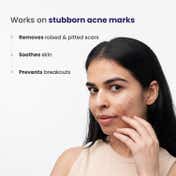 Re'equil Acne Scars & Pits Removal Pitstop Gel (30g)