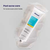 Re'equil Acne Scars & Pits Removal Pitstop Gel (30g)