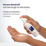 Re'equil Pre Wash AntiRecurrence Dandruff Lotion (100ml)