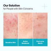 MEDIHEAL Madecassoside Blemish Repair Serum (40 ml)