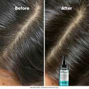 L'OREAL PROFESSIONNEL Scalp Advanced 5-in-1 Professional Leave-in Serum for Scalp Care (90 ml)