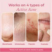 The Pink Foundry Overnight Acne Spot Corrector (15ml)