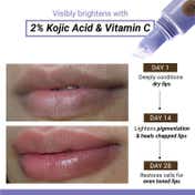 Sereko 2% Kojic Acid Pigmentation Lip Balm for Dark Dry and Chapped Lips - Affogato (8 g)