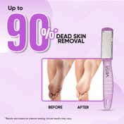 VEGA Dual-Sided Pedicure Foot File for Dead Skin & Cracked Heels Removal for Men & Women (PD-03)