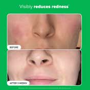 PAULA'S CHOICE Boost 10% Azelaic Acid Booster (5 ml)