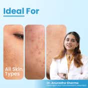 FCL AHA Lightening Gel Glycolic Acid Treats Hyperpigmentation Dark spots Reduce Dark Spots (15 ml)