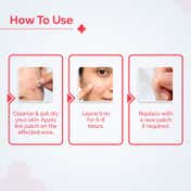The Derma Co 2% Sali-Cinamide Hydrocolloid Acne Patches (36 pcs)
