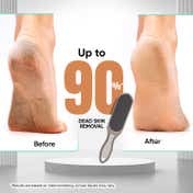 VEGA Large Emery Foot File for Removing Dead Skin & Callus Easily Soft Feet Reusable File (PD-12)