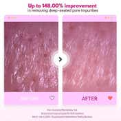 ZIGTAG Berry Smoothie Scrub Cleanser, Gentle Exfoliating Pore Cleansing (130 ml)
