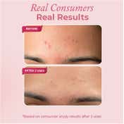 The Pink Foundry Overnight Acne Spot Corrector (15ml)