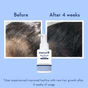 WishCare Hair Growth Serum Concentrate with Redensyl In Vivo Tested Boosts Hair Growth (20 ml)