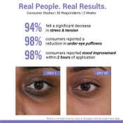 Sereko Under Eye Gel Pen for Puffy Eyes Dark Circles and Stress Relief (10 ml)