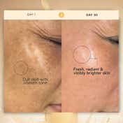 RAS Luxury Skincare Daily Micro-Resurfacing Milky Essence Toner (50 ml)