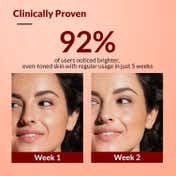 Fixderma Tranexamic Acid + 2%Kojic Acid + 1%Arbutin SKARFIX TX Face Cream For Pigmentation (30g)