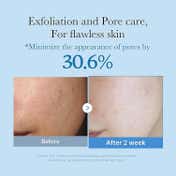 medicube Zero Pore Toner (250 ml)
