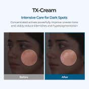 Dr.Melaxin Tx-Cream Targets Dark Spots Hyperpigmentation Post-Acne Scars and Melasma (50 g)