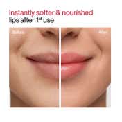 WishCare Tinted Ceramide Lip Balm for Dark Pigmented Lips with SPF50 PA+++ Heals Chapped Lips (5 g)