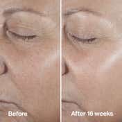 CLINIQUE Age Defense Routine Skincare Set (4 pcs)