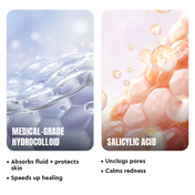 KIRO Zit. Zap. Zoop Pimple Patches 02 24N - Transparent Round Shape