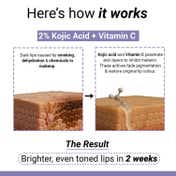 Sereko 2% Kojic Acid Pigmentation Lip Balm for Dark Dry and Chapped Lips - Affogato (8 g)
