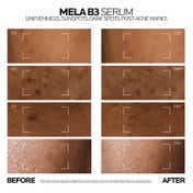 LA ROCHE-POSAY Mela B3 Serum For Anti-Dark Spot & Pigmented Skin With Melasyl + Niacinamide (10 ml)