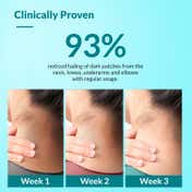 Fixderma Nigrifix Cream for Dark Neck Ankles Knuckles Elbows Underarm Whitening (100 g)