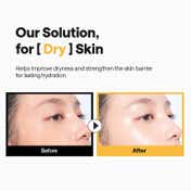MEDIHEAL Ceramide Essential Mask for Moisture Barrier (24 ml)