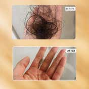 Ras Luxury Skincare Root Ine Hair Growth Serum with 19.5% Scalp Actives (50 ml)