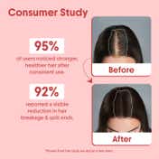 Aravi Organic Pure Batana Hair Oil For Hair Growth - Derived From American Oil Palm Nut (15 ml)