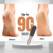 Vega Large Emery Foot File, Pedicure Tool Removes Dead Skin & Callus (PD-12)