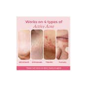 The Pink Foundry Overnight Acne Spot Corrector (15ml)
