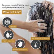 The Skin Story Anti Dandruff Shampoo (250 ml)