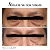 Novology Pro-Lift Cellular Restoration Under Eye Crème Gel,Under Eye Bags,Puffiness,Wrinkles (15 g)