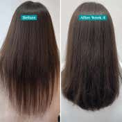 Pilgrim Redensyl & Anagain Hairfall Control Shampoo (200 ml)