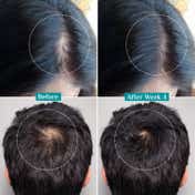 Pilgrim 3% Redensyl & 4% Anagain Advanced Hair Growth Serum (100 ml)