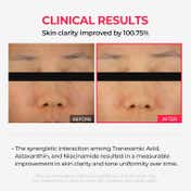 Dr.Melaxin Tx-Astaxanthin Overnight Wrapping Mask (80 ml)