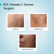 Pilgrim 15% Vitamin C Face Serum For Advanced Brightness (20 ml)