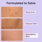 Foxtale Exfoliating Body Wash 2% Salicylic Acid Zinc PCA Reduces Body Acne Smoothens Skin (250 ml)