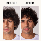 Fix My Curls Cleansing Shampoo with Apple Cider Vinegar Tea Tree & Rosemary Oil (50 ml)