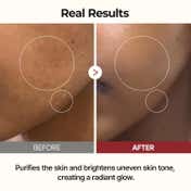 Dr.Melaxin Peel Shot Glow White Rice Toner (200 ml)