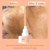 WishCare Super Bright C16 Vitamin C Face Serum for Glowing Skin Reduces Pigmentation (30 ml)