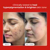 Conscious Chemist +5 Antioxidant Complex Rapid Glow & Brightening Face Serum (50ml)